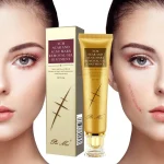30g Acne Scar Removal Cream Face Gel
